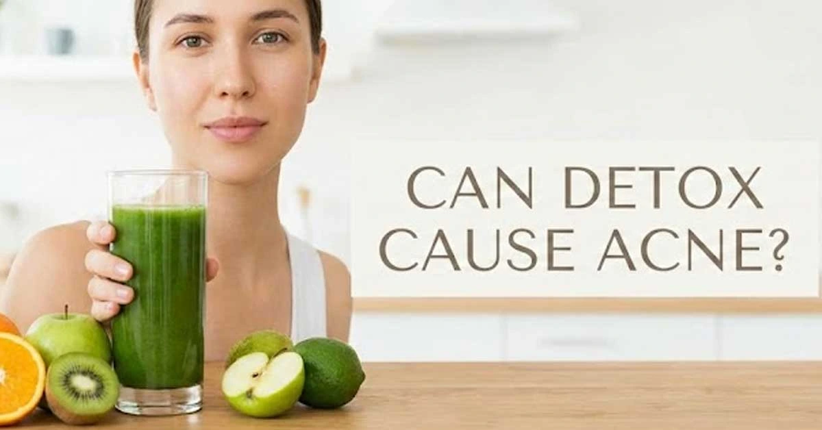 Can Detox Cause Acne? Truth Behind Detox Breakouts Explained